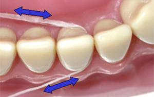 糸ようじで歯間の横部分を掃除するイメージ